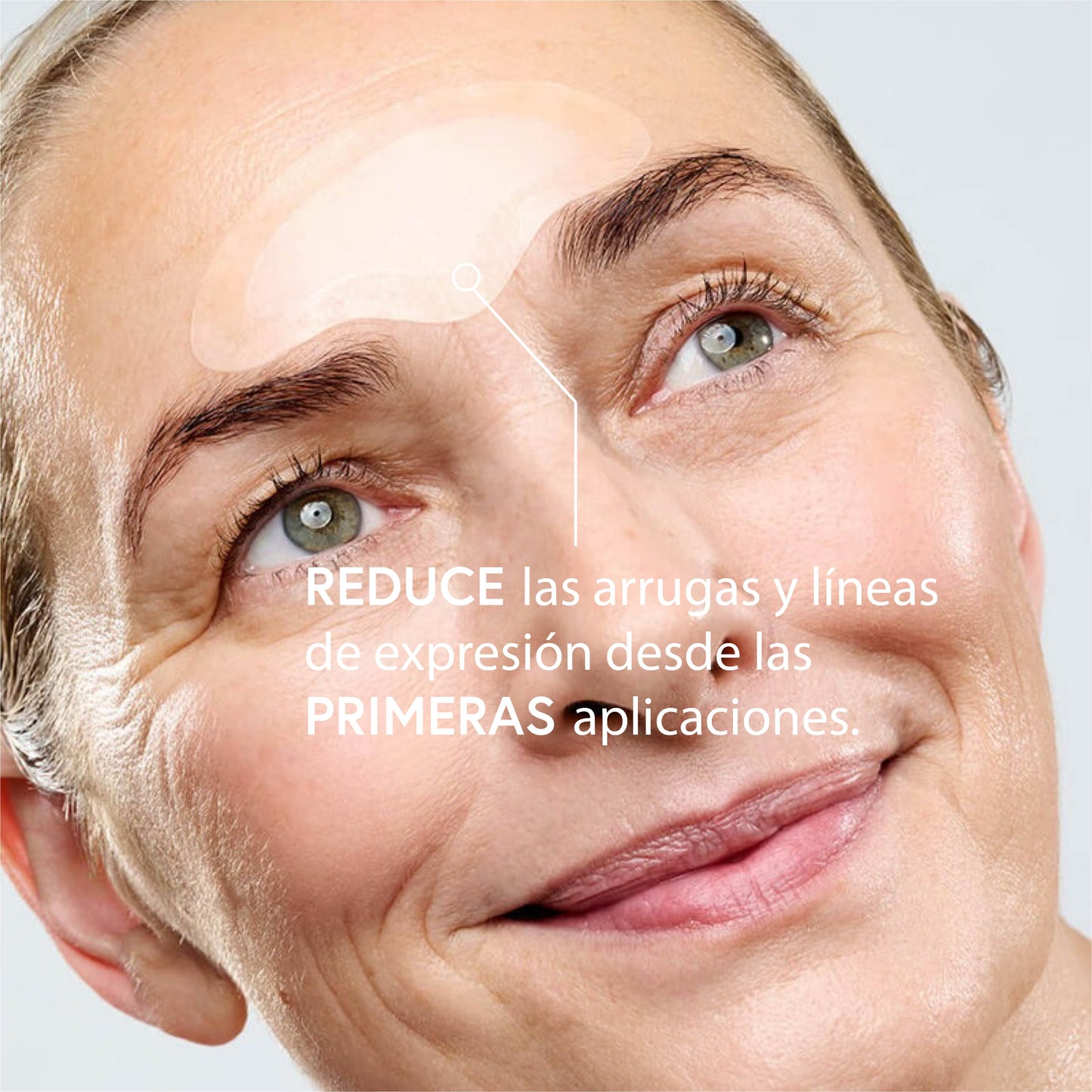 Patchs frontal Anti-Âge Microneedling