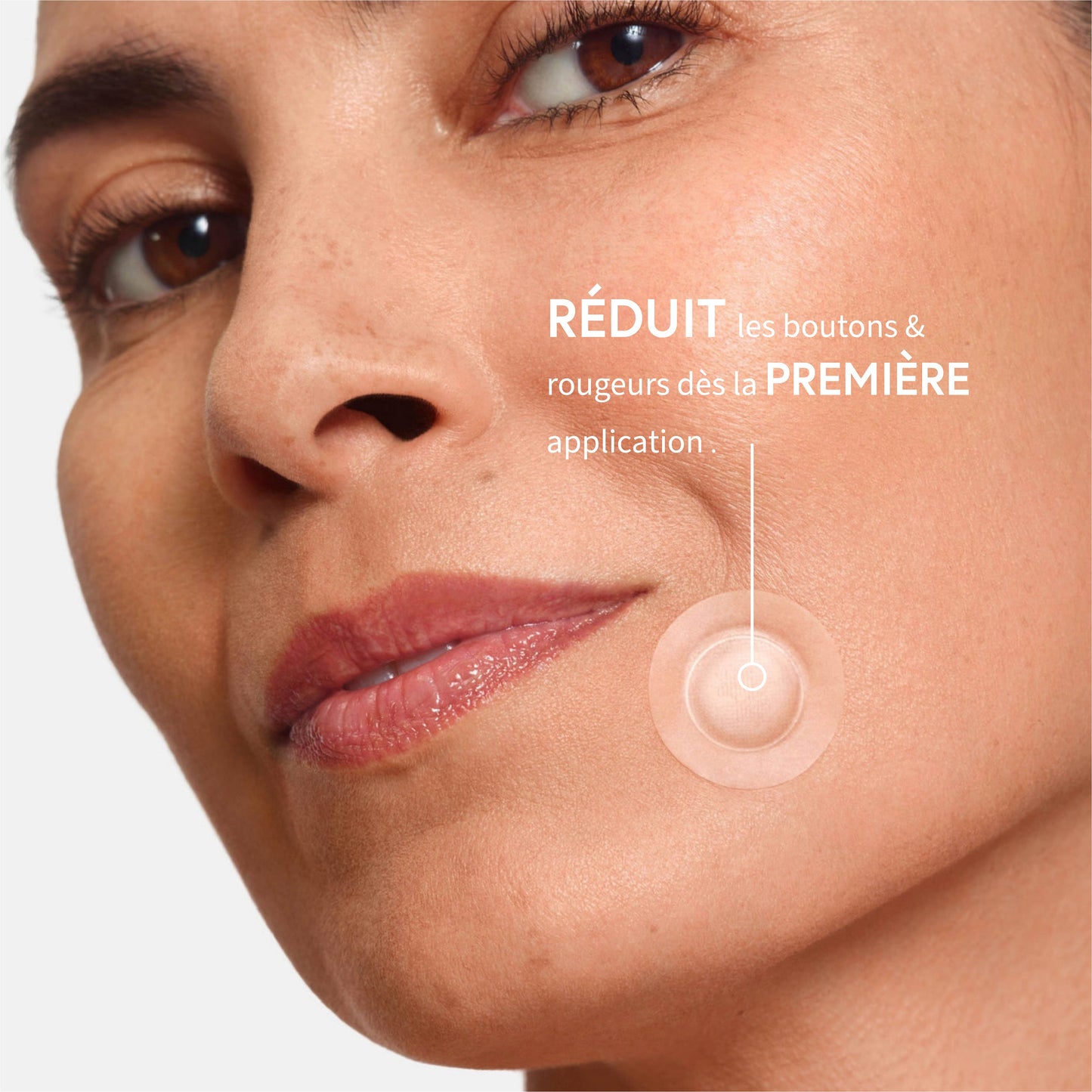 Patchs Anti-Acné Microneedling