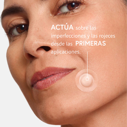 Patchs Anti-Acné Microneedling